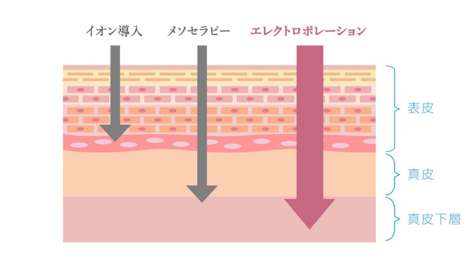 エレクトロポレーション(スプリング)イメージ