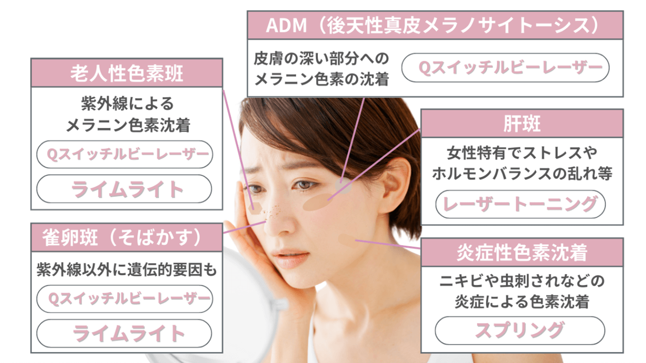 当院のシミ取り治療