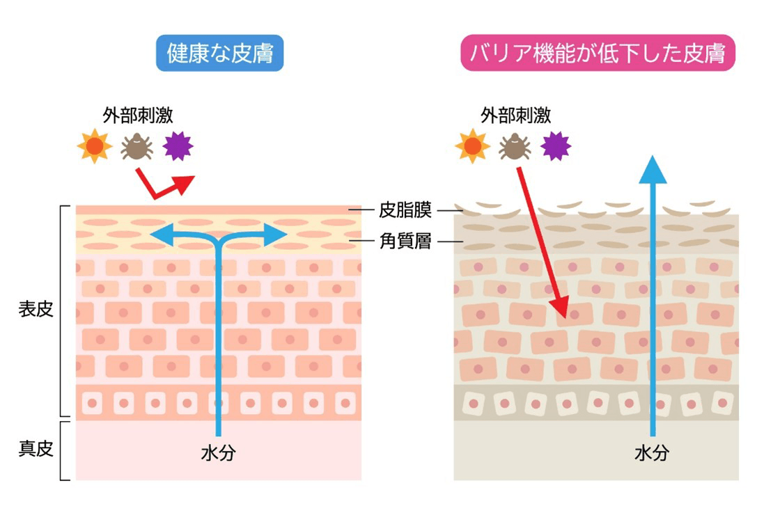 バリア機能を低下させる要因