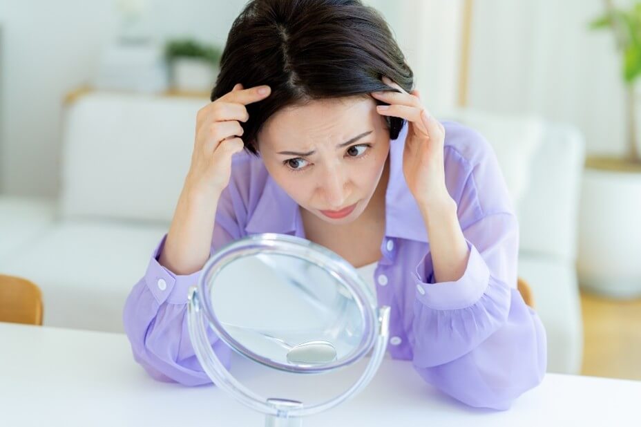 女性の薄毛（FAGA）治療